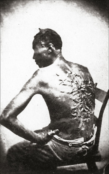 File:Slave with scars from whip.jpg